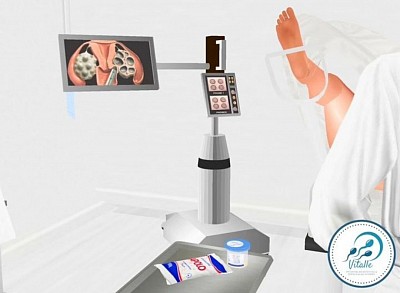 Inseminação Artificial